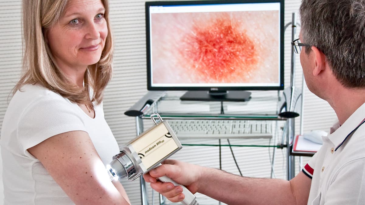 Skin Tumour Aftercare