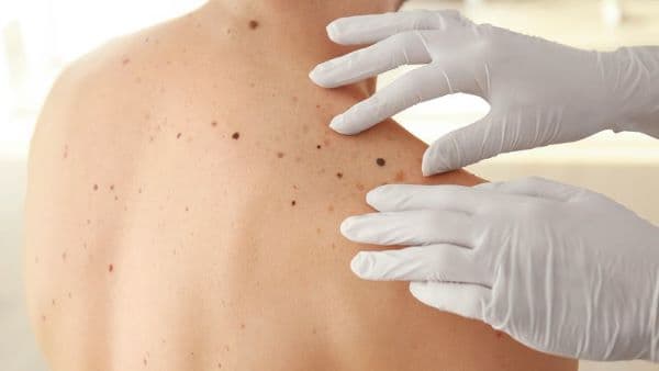 Skin & Sexually Transmitted Diseases
