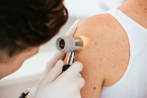 Skin Cancer Screening